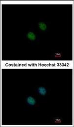GCN5 Polyclonal Antibody