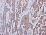 GNAI1 Antibody in Immunohistochemistry (Paraffin) (IHC (P))
