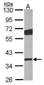 GNB2 Polyclonal Antibody