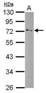 GPD2 Polyclonal Antibody