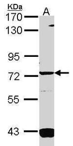 GUCY1A3 Polyclonal Antibody