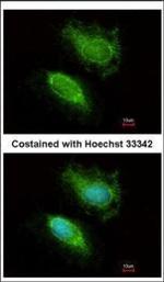 HIP2 Polyclonal Antibody