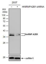 hnRNP A2B1 Antibody in Western Blot (WB)