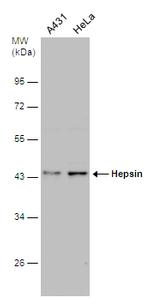 Hepsin Polyclonal Antibody