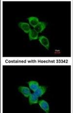 IDH1 Antibody in Immunocytochemistry (ICC/IF)