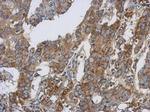 IDH1 Antibody in Immunohistochemistry (Paraffin) (IHC (P))