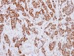 IDH3A Polyclonal Antibody