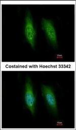 KIFC3 Polyclonal Antibody