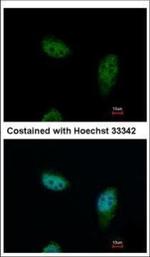 IPO5 Polyclonal Antibody