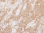 LCN1 Polyclonal Antibody