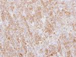 L-Plastin Polyclonal Antibody