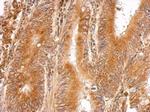 LMAN1 Polyclonal Antibody