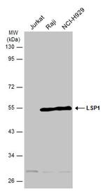 LSP1 Antibody in Western Blot (WB)