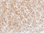 MPI Polyclonal Antibody
