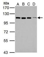 TRIM37 Polyclonal Antibody