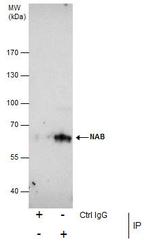 NAB2 Antibody in Immunoprecipitation (IP)