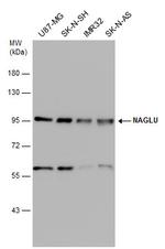NAGLU Antibody in Western Blot (WB)