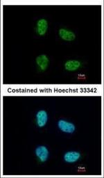 NCBP1 Antibody in Immunocytochemistry (ICC/IF)