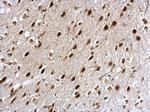 NCBP1 Antibody in Immunohistochemistry (Paraffin) (IHC (P))