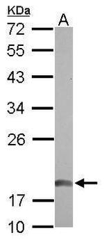 NDUFAB1 Antibody in Western Blot (WB)