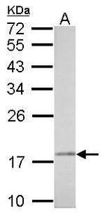 NDUFAB1 Antibody in Western Blot (WB)