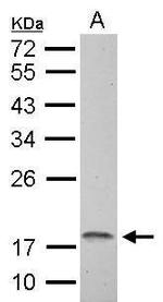 NDUFAB1 Antibody in Western Blot (WB)