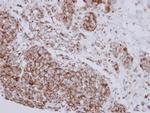 NDUFB10 Antibody in Immunohistochemistry (Paraffin) (IHC (P))