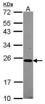 NDUFB10 Antibody in Western Blot (WB)