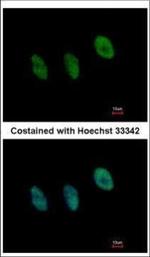 NFYB Antibody in Immunocytochemistry (ICC/IF)