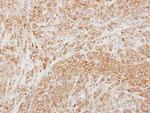 NPTX2 Polyclonal Antibody