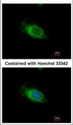 Nardilysin Polyclonal Antibody