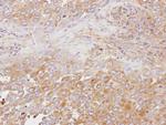 OSBP Polyclonal Antibody