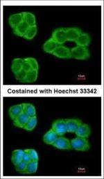 EBP1 Polyclonal Antibody