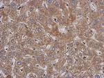 PABPC3 Polyclonal Antibody