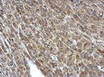 PCCA Polyclonal Antibody