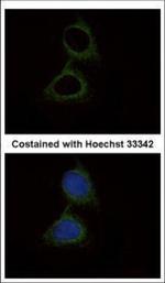 SERPINB6 Polyclonal Antibody
