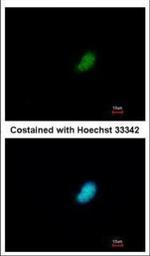 POLR2E Polyclonal Antibody