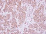 PPEF1 Polyclonal Antibody