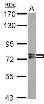 PPEF1 Antibody in Western Blot (WB)