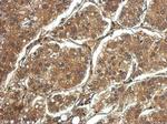 PRG2 Polyclonal Antibody