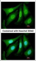PSMC5 Polyclonal Antibody