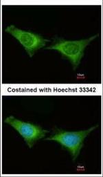 PSMC6 Polyclonal Antibody