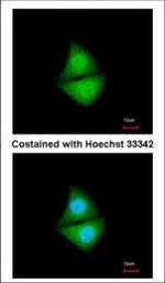 PSMD4 Polyclonal Antibody