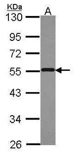 PSMD4 Antibody in Western Blot (WB)