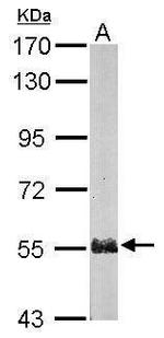 PSMD5 Antibody in Western Blot (WB)