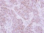 PSMD12 Antibody in Immunohistochemistry (Paraffin) (IHC (P))