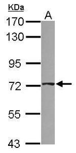 ABCD4 Polyclonal Antibody