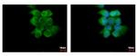ABCD4 Polyclonal Antibody