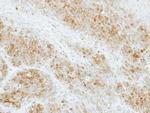 RAB2A Antibody in Immunohistochemistry (Paraffin) (IHC (P))