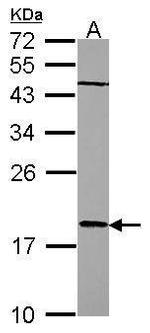 RARRES3 Polyclonal Antibody